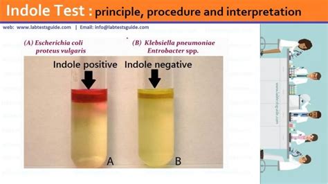 citrobacter koseri indole test.